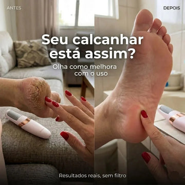 PéDeSeda™ | Acabe com rachaduras nos pés